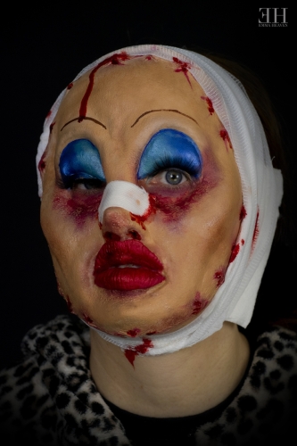 Botched -December 2021